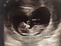 Baby Scan 3.jpg