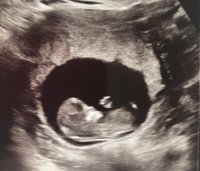 Baby Scan .jpg