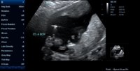 ITS A BOY!.jpg