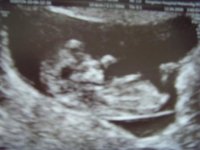 Baby 12 weeks 003.jpg