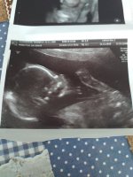 20 week scan pick 1.jpg
