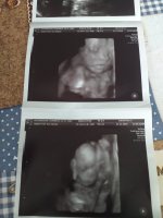 20 week scan pick 2.jpg