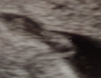 Screenshot_20191227-100336_Gallery.jpg