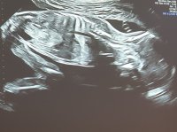 20200218_202505.jpg