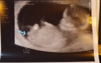 baby scan_LI (2).jpg