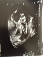 ultrasound_20200616_01.jpg