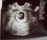 7-22-20 Ultrasound.jpg
