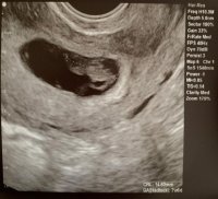 7-28-20 Ultrasound.JPG