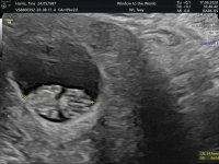 scan_image10.jpg
