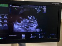 D09B9756-8B43-4E71-B7DE-9ED1CC60C545.jpeg