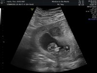 scan_image2_518356876329759.jpg