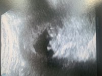 EF1F07C1-F0D9-44D1-9F6E-034CE58B0E27.jpeg