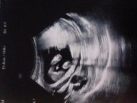 20201117_064234.jpg