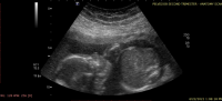 20210505_222758.png 20210505_222758.png