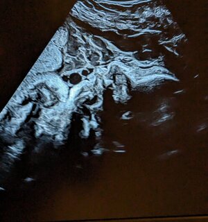 PXL_20231228_174853152.jpg