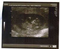 Scan11w4d.jpg