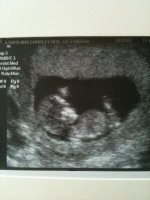 12 wk scan pic.jpg