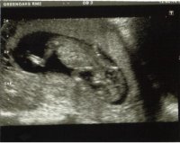 baby1.jpg
