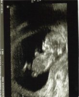 baby2.jpg