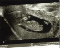 baby3.jpg
