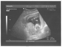 13 weeks 5 days (1).jpg