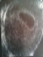 Baby 07:05:2010.jpg