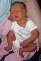 nice jaundice (3).jpg