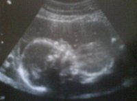 21 week.jpg