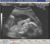 20 weeks 001.jpg