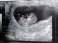 babypic1.jpg