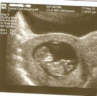 12 weeks gestation may 17 2010 B.jpg