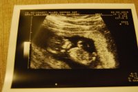 Baby Allen - 12 weeks 2 days 295.jpg