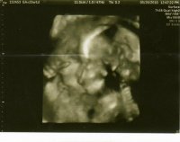 Aurie at 25 weeks #1.jpg