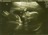 Aurie at 25 weeks #4.jpg