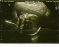 Aurie at 25 weeks #2.jpg