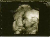 Aurie at 25 weeks #5.jpg