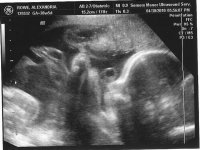 28wk scan.jpg