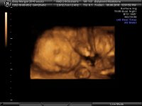 BABYBOND_6.jpg