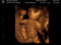 BABY @ 17 WEEKS_12.jpg