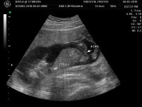 BABY @ 17 WEEKS_5.jpg