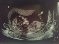 02012009314.jpg