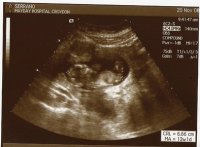 12 week scan - small.jpg
