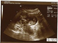 12 week scan - large.jpg