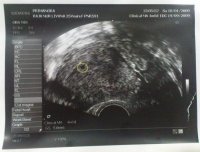 scan at 4 weeks 2.jpg