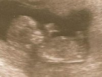 baby 5.jpg