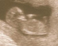 baby 1.jpg