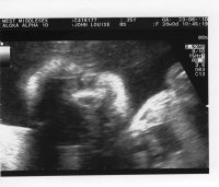 Face 28 wks.jpg