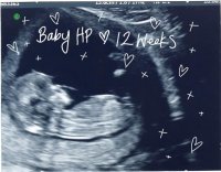 BabyHP12weeks.jpg