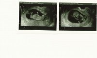 12wks 5days Scan A & B 2.jpg