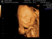 Baby_11.jpg